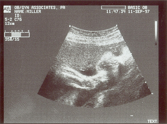 HMiller media pix-1001